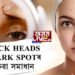 Black heads বা DARK SPOTৰ ঘৰুৱা সমাধান