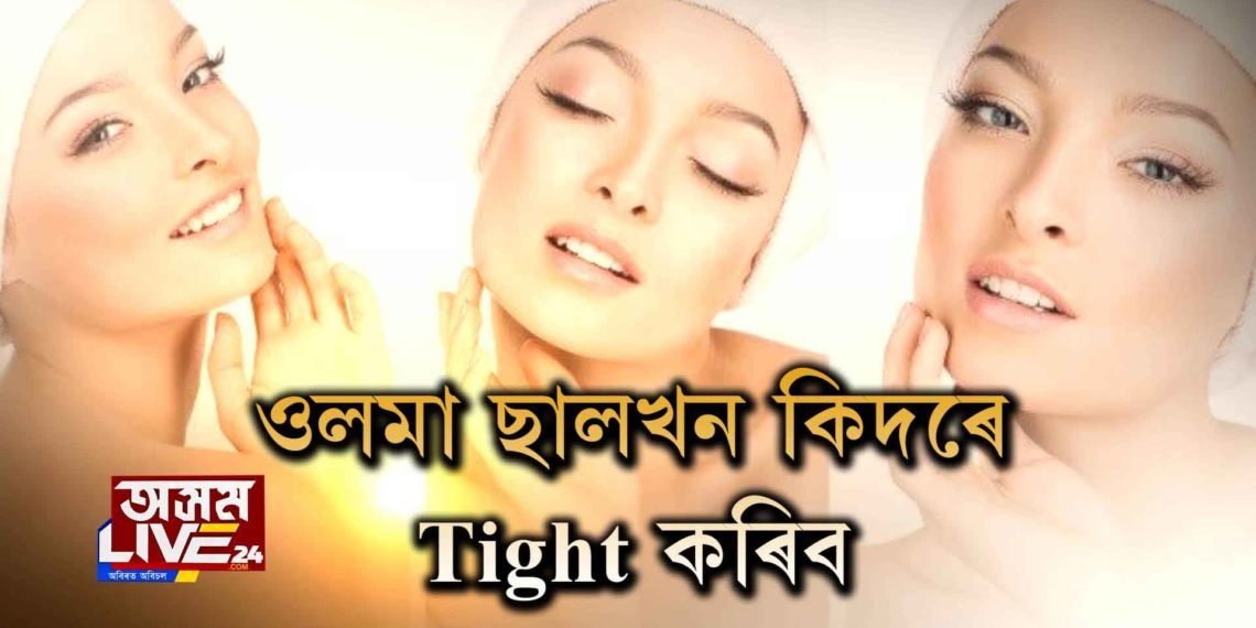 ওলমা ছালখন কিদৰে Tight কৰিব