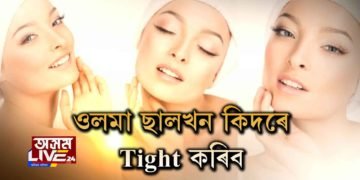 ওলমা ছালখন কিদৰে Tight কৰিব