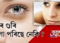 DARK CIRCLES পৰিছে নেকি আপোনাৰ চকুৰ তলত?
