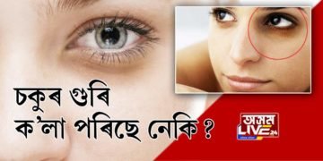 DARK CIRCLES পৰিছে নেকি আপোনাৰ চকুৰ তলত?