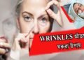 WRINKLES কেনেদৰে আঁতৰাব?