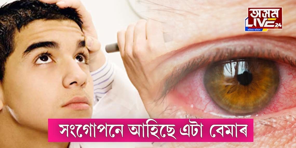 ক’ৰোনাৰ মাজতেই আৰু এটা বেয়া খবৰ