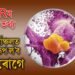 আগন্তুক ৫ বছৰত উত্তৰ-পূর্বাঞ্চলত ভয়াৱহ ৰূপ ল’ব কর্কট ৰোগে