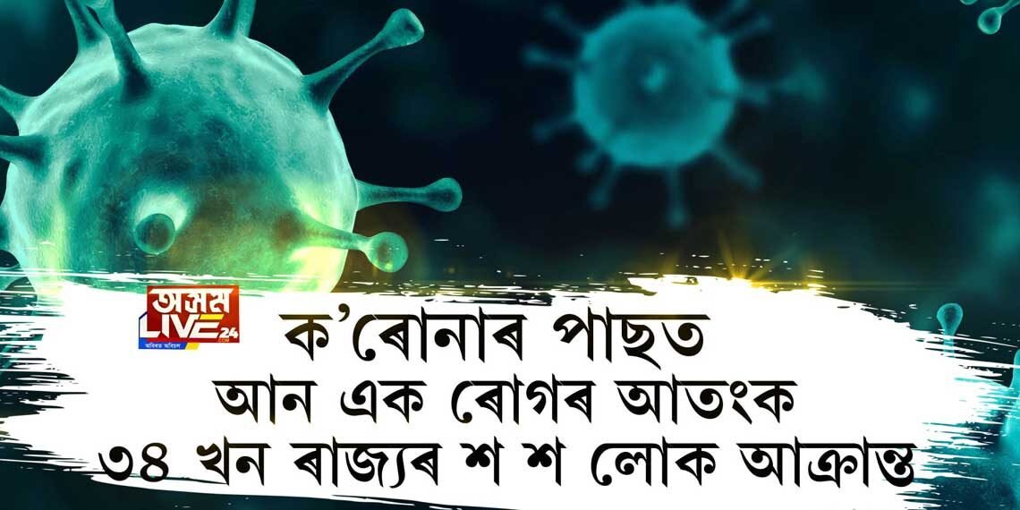 ক’ৰোনাৰ পাছত আন এক ৰোগৰ আতংক