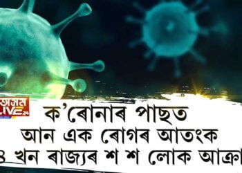 ক’ৰোনাৰ পাছত আন এক ৰোগৰ আতংক