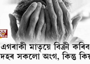 এগৰাকী মাতৃয়ে বিক্ৰী কৰিব দেহৰ সকলো অংগ, কিন্তু কিয়?