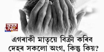 এগৰাকী মাতৃয়ে বিক্ৰী কৰিব দেহৰ সকলো অংগ, কিন্তু কিয়?