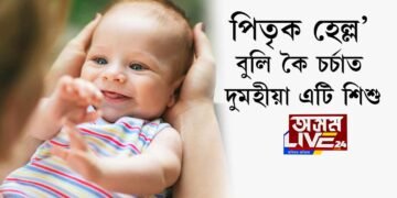 পিতৃক হেল্ল’ বুলি কৈ চর্চাত দুমহীয়া এটি শিশু