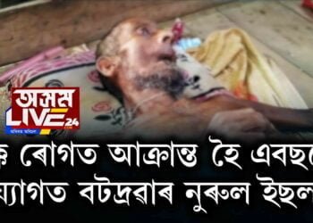 বৃক্ক ৰোগত আক্ৰান্ত হৈ এবছৰে শয্যাগত বটদ্ৰৱাৰ নুৰুল ইছলাম