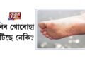 ভৰিৰ গোৰোহা ফাটিছে নেকি?