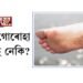 ভৰিৰ গোৰোহা ফাটিছে নেকি?
