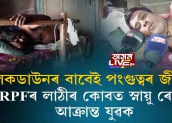 লকডাউনৰ বাবেই পংগুত্বৰ জীৱন