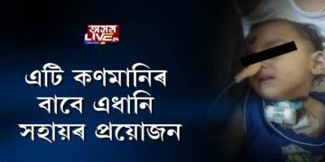 এটি কণমানিৰ বাবে এধানি সহায়ৰ প্ৰয়োজন