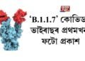 ‘B.1.1.7’ কোভিড ভাইৰাছৰ প্ৰথমখন ফটো প্ৰকাশ
