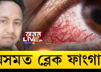 অসমত ব্লেক ফাংগাছ; ব্লেক ফাংগাছত আক্ৰান্ত হৈ মৃত্যু নগাঁৱৰ যুৱকৰ