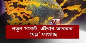 এইসমূহ লক্ষণ থাকিলে আপোনাৰো হ’ব পাৰে য়েল্ল’ ফাংগাছ