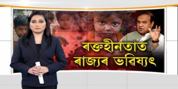 ৰোগ-পুষ্টিহীনতাত ৰাজ্যৰ মানৱ সম্পদ