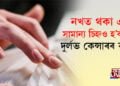 এগৰাকী মহিলাৰ নখত এটা সামান্য চিন; চিকিৎসকে চিনাক্ত কৰিলে দুৰ্লভ কেন্সাৰ