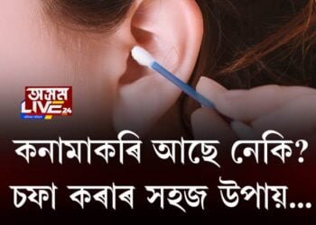 কনামাকৰি আছে নেকি? চফা কৰাৰ সহজ উপায়…
