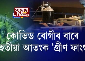 কোভিড ৰোগীৰ বাবে শেহতীয়া আতংক ‘গ্ৰীণ ফাংগাছ’