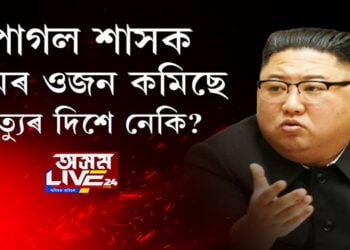 কিম জং উনৰ ওজন কমিছে