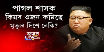 কিম জং উনৰ ওজন কমিছে