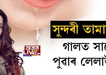সুন্দৰী তামান্নাই গালত সানে পুৱাৰ লেলাউটি!