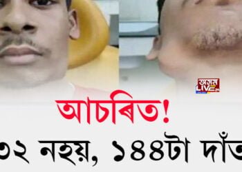 আচৰিত! ৩২ নহয়, ১৪৪টা দাঁত