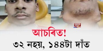 আচৰিত! ৩২ নহয়, ১৪৪টা দাঁত