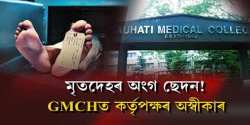 মৃতদেহৰ অংগ ছেদন GMCHত!