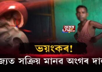 ভয়ংকৰ! ৰাজ্যত সক্ৰিয় মানৱ অংগৰ দালাল