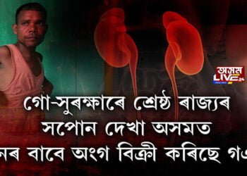 কেঁচু খান্দোতে সাপ ওলাইছে, দাৰিদ্ৰতাৰ তাড়নাত বিক্ৰী কিডনী