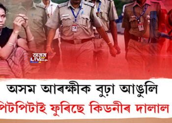 ৰাজ্যত পুনৰ সৰৱ কিডনীৰ দালাল চক্ৰ