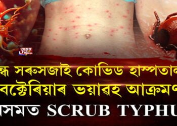 বন্ধ হ’ব সৰুসজাইৰ কোভিড হাস্পতাল