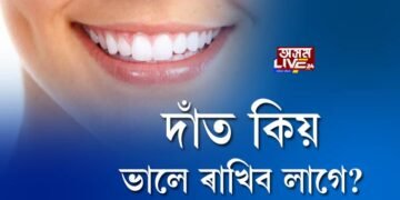 দাঁত কিয় ভালে ৰাখিব লাগে?