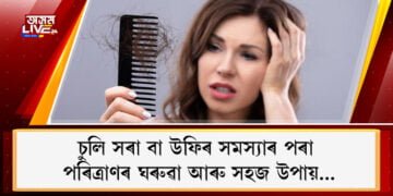 ঠাণ্ডাৰ দিনকেইটাত উফিৰ সমস্যাত ভূগিছে নেকি? এইটো হেয়াৰ মাস্ক ব্যৱহাৰ কৰিলে সোনকালেই উপশম হ’ব এই সমস্যাৰ পৰা