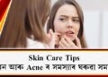 Skin Care Tips: শালমন আৰু Acne ৰ সমস্যাই মুখখনৰ উজ্জ্বলতা নাইকিয়া কৰিছে নেকি? ব্যৱহাৰ কৰক এইকেইটা ঘৰুৱা Tips