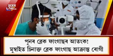 পুনৰ ব্লেক ফাংগাছৰ আতংক! কোভিড আক্ৰান্ত ৰোগীৰ দেহত ধৰা পৰিছে ব্লেক ফাংগাছৰ অৱস্থিতি