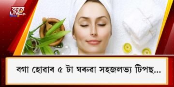 বগা হোৱাৰ ৫ টা ঘৰুৱা সহজলভ্য টিপছ…