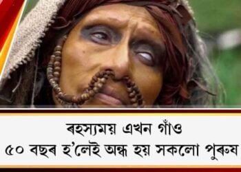 ৰহস্যময় এখন গাঁও: ৫০ বছৰ হ’লেই অন্ধ হয় সকলো পুৰুষ; কাৰণ জানি আচৰিত হ’ব