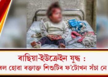ৰাছিয়া-ইউক্ৰেইন যুদ্ধ : ভাইৰেল হোৱা ৰক্তাক্ত শিশুটিৰ ফ’টোখন সঁচা নে ভুৱা?