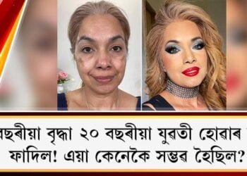 ৮০ বছৰীয়া বৃদ্ধা ২০ বছৰীয়া যুৱতী হোৱাৰ ৰহস্য ফাদিল! এয়া কেনেকৈ সম্ভৱ হৈছিল?