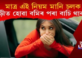 মাত্ৰ এই নিয়ম মানি চলক, এতিয়াৰ পৰা গাড়ীত উঠিলেও বমি নহয় আৰু আপোনাৰ