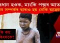 সাৱধান হওক, যৌন সম্পৰ্কৰ দ্বাৰাও সংক্ৰমিত হ’ব পাৰে মাংকি পক্স!