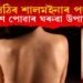 পিঠিৰ শালমইনাৰ পৰা কেনেকৈ পৰিত্ৰাণ পাব? চাওক দুটামান ঘৰুৱা উপায়…