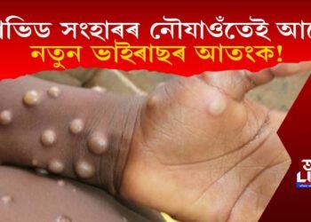 কোভিড সংহাৰৰ নৌযাওঁতেই আকৌ নতুন ভাইৰাছৰ আতংক!