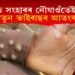 কোভিড সংহাৰৰ নৌযাওঁতেই আকৌ নতুন ভাইৰাছৰ আতংক!