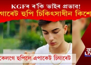 KGFৰ প্ৰভাৱ! চিগাৰেট হুপি চিকিৎসাধীন হ’ল কিশোৰ, ক’ত ঘটিল এই ঘটনা?