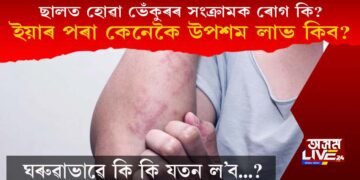 ছালত হোৱা ভেঁ‌কুৰৰ সংক্ৰামক ৰোগৰ পৰা কেনেকৈ উপশম লাভ কৰিব?